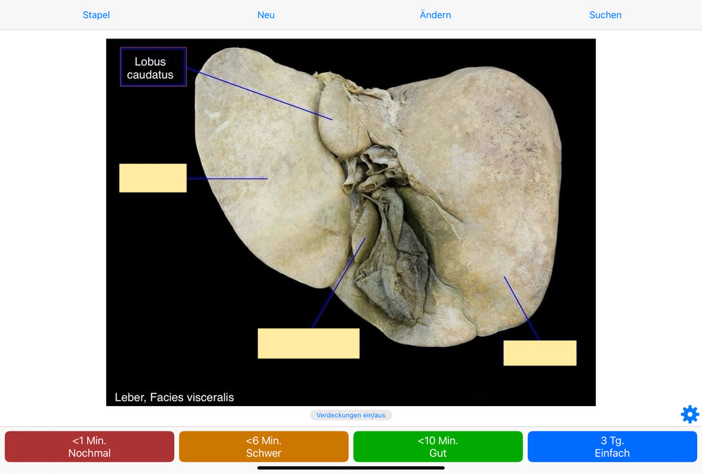 Anatomie Anki-Kartenset